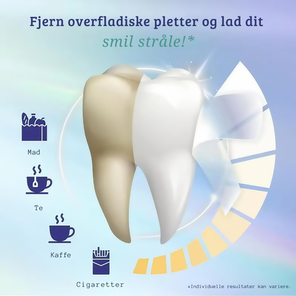 Premium Whitening Strips